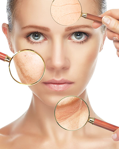 Aging skin