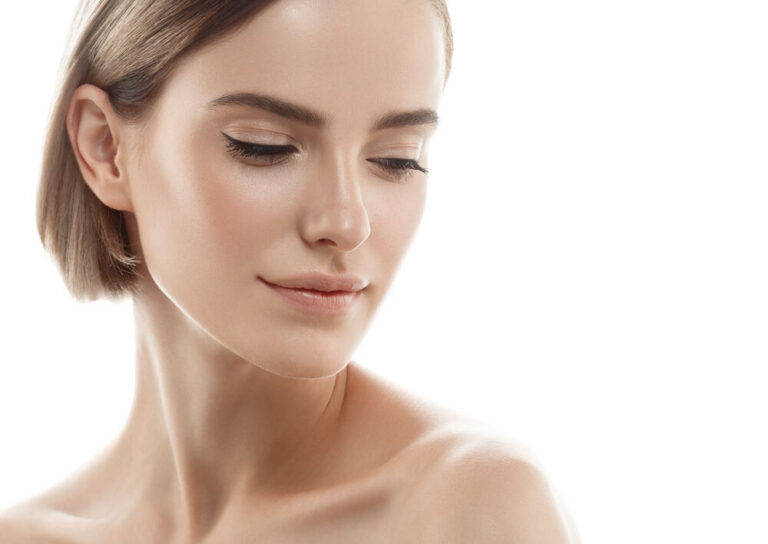Melasma