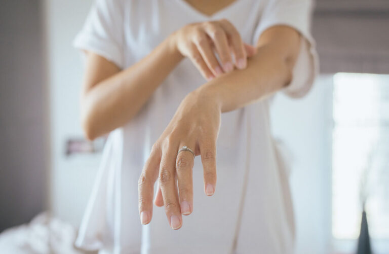 Psoriasis