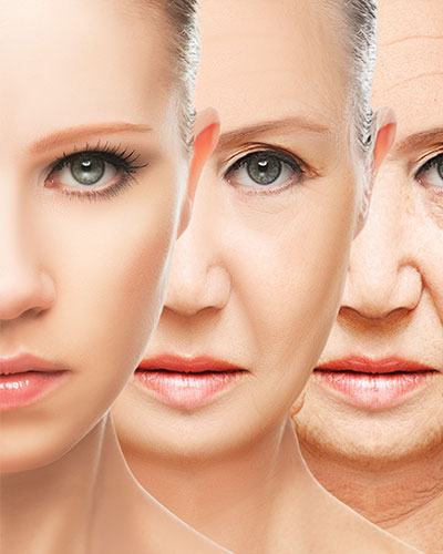 Lines & wrinkles