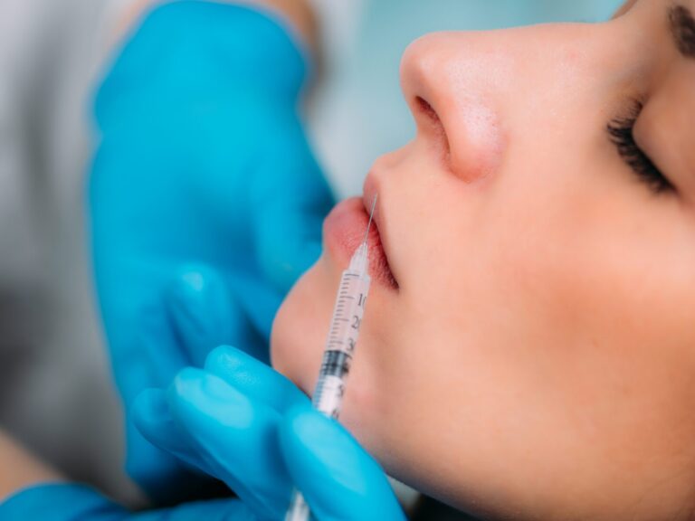 Advanced Lip Filler Techniques