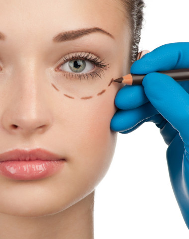 How blepharoplasty can roll back the years