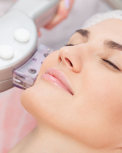 IPL photofacial