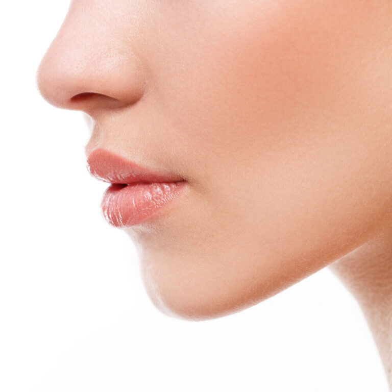 Non-surgical nose reshaping