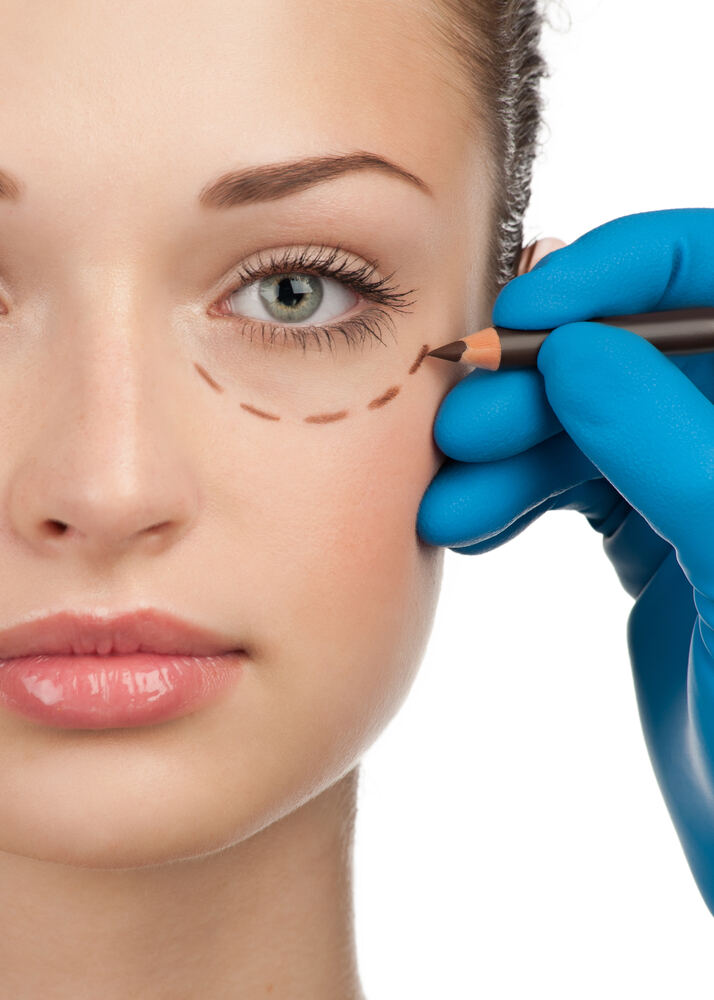 Upper eyelid surgery